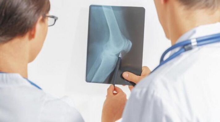 Après le diagnostic nécessaire de l'arthrose de l'articulation du genou, les médecins prescrivent un traitement complexe