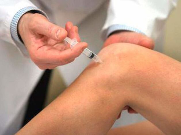 L'injection intra-articulaire est l'une des formes de traitement les plus progressives de l'arthrose de l'articulation du genou. 
