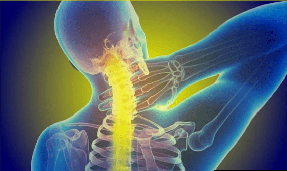 Le département cervical fait mal