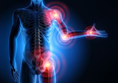 Arthrose