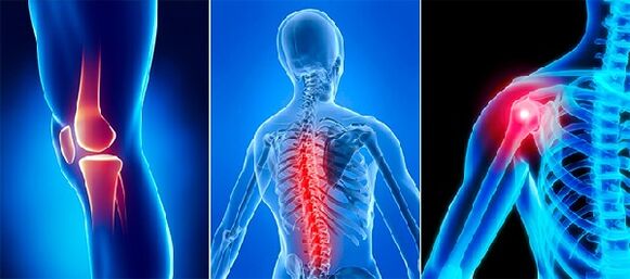 Douleurs articulaires dans l'arthrose