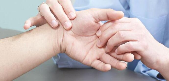 arthrite